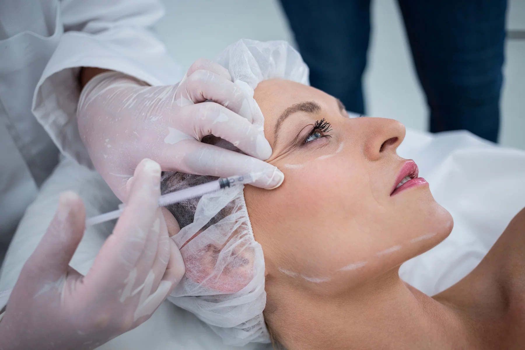 Profissional realizando procedimento facial para linhas de expressão