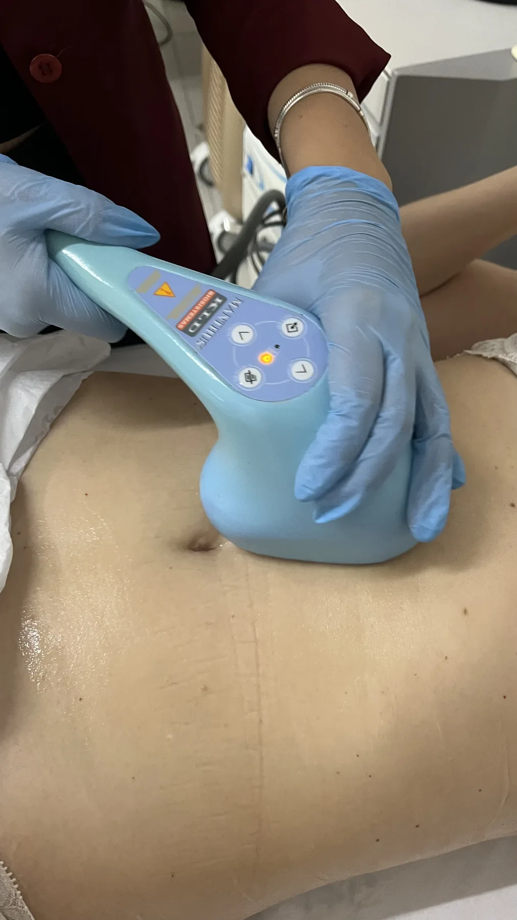 Ultrassom de Alta Potência - La Forme Center